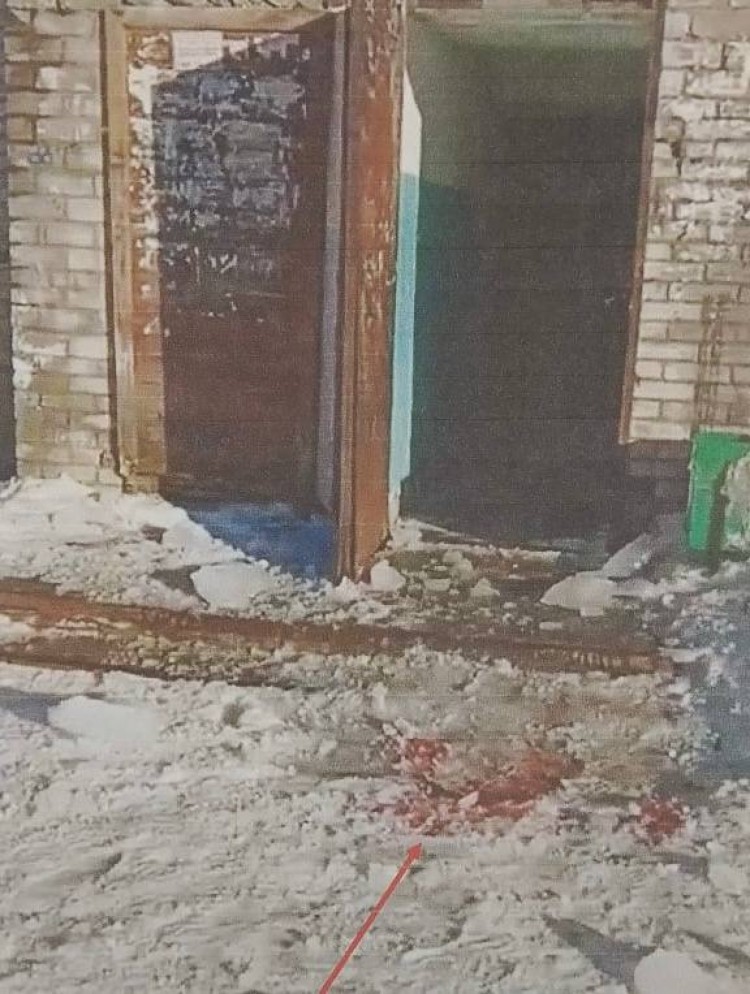 В суд направлено уголовное дело о падении ледяной глыбы на голову пожилого человека